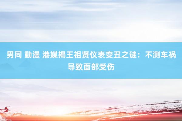 男同 動漫 港媒揭王祖贤仪表变丑之谜：不测车祸导致面部受伤